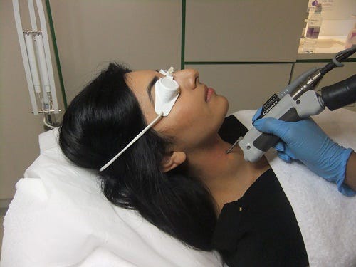 Hair Removal