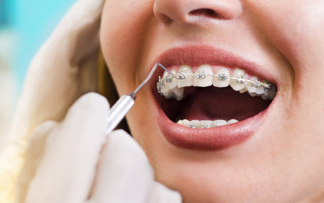 Orthodontics